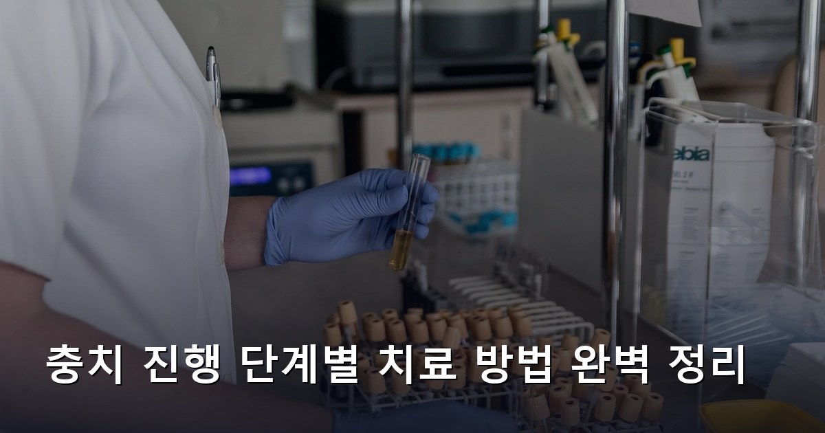 충치 진행 단계별 치료 방법 완벽 정리