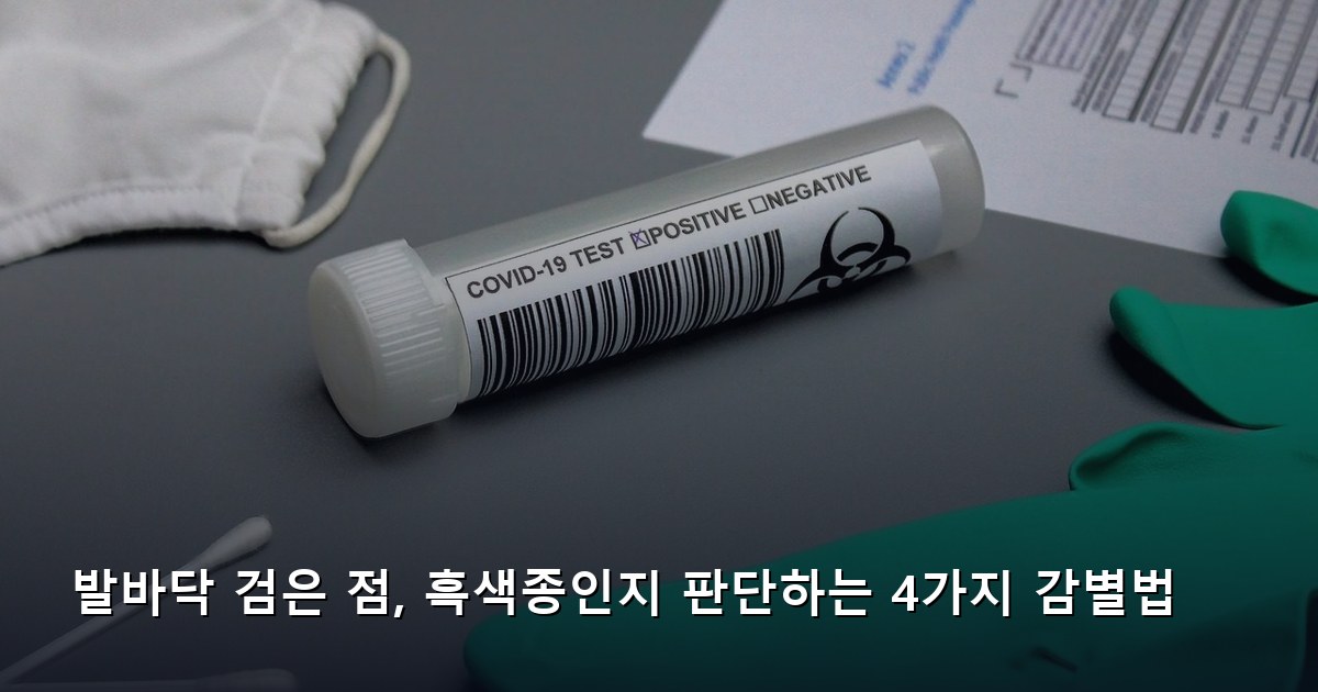 발바닥 검은 점, 흑색종인지 판단하는 4가지 감별법